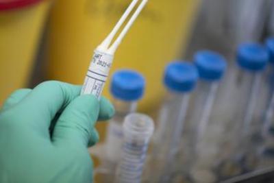 Coronavirus, nuovo focolaio in Germania: 400 positivi in un mattatoio  