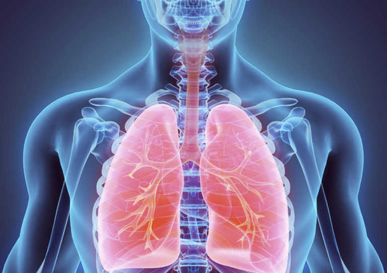 Covid, più morti in terapia intensiva con doppio danno a polmoni 