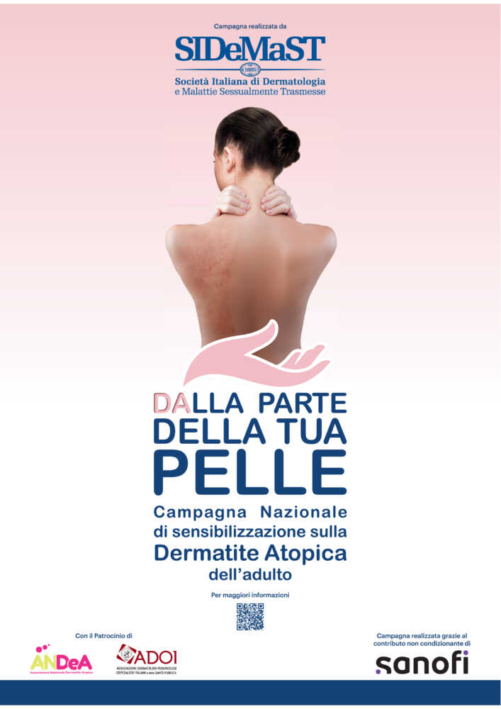 TORNANO IN CAMPANIA GLI OPEN DAY SULLA DERMATITE ATOPICA. CONSULTI GRATUITI A NAPOLI E CAVA DE’ TIRRENI